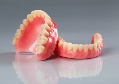Full and Partial Dentures